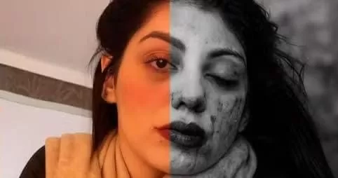 Esposa-de-Lutador-cearense-vitima-de-violencia-domestica-nos-Estados-Unidos-posta-foto-com-rosto-machucado-aspect-ratio-40-21